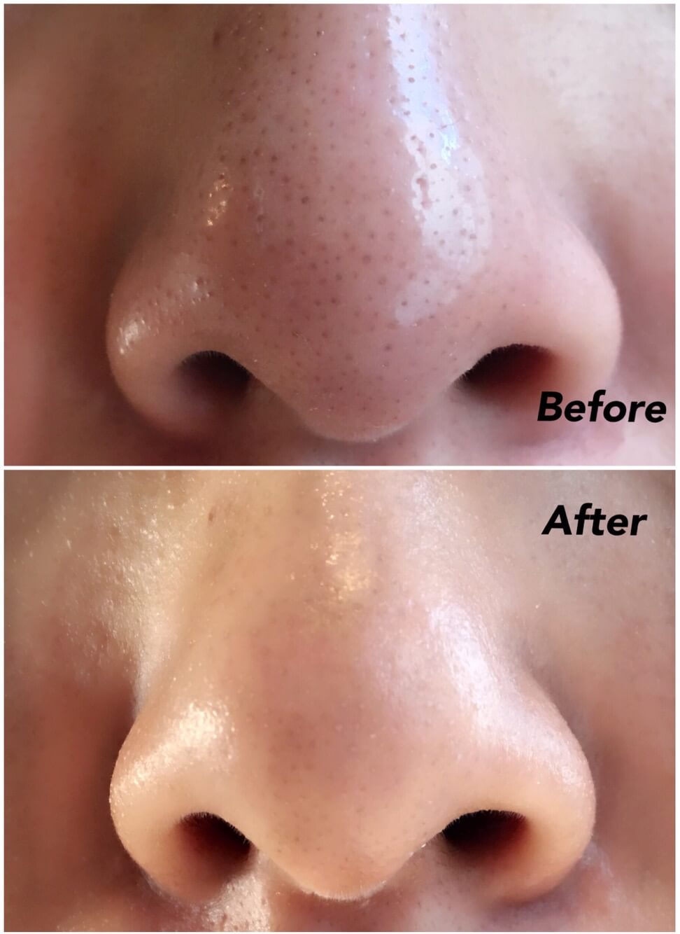 Me factory 1 Step piggy nose strip